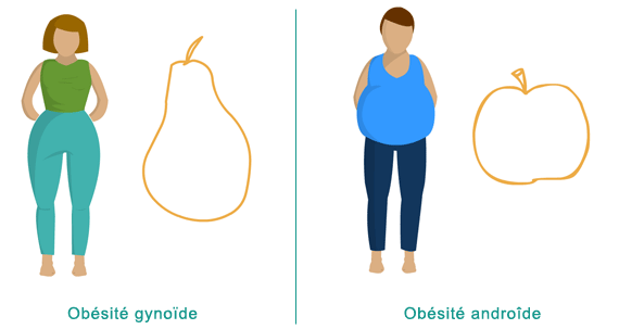 différents type obésité